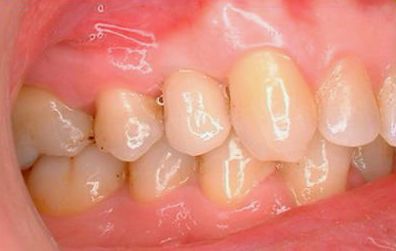 Clínica Dental Nieves Golbano Meléndez dientes